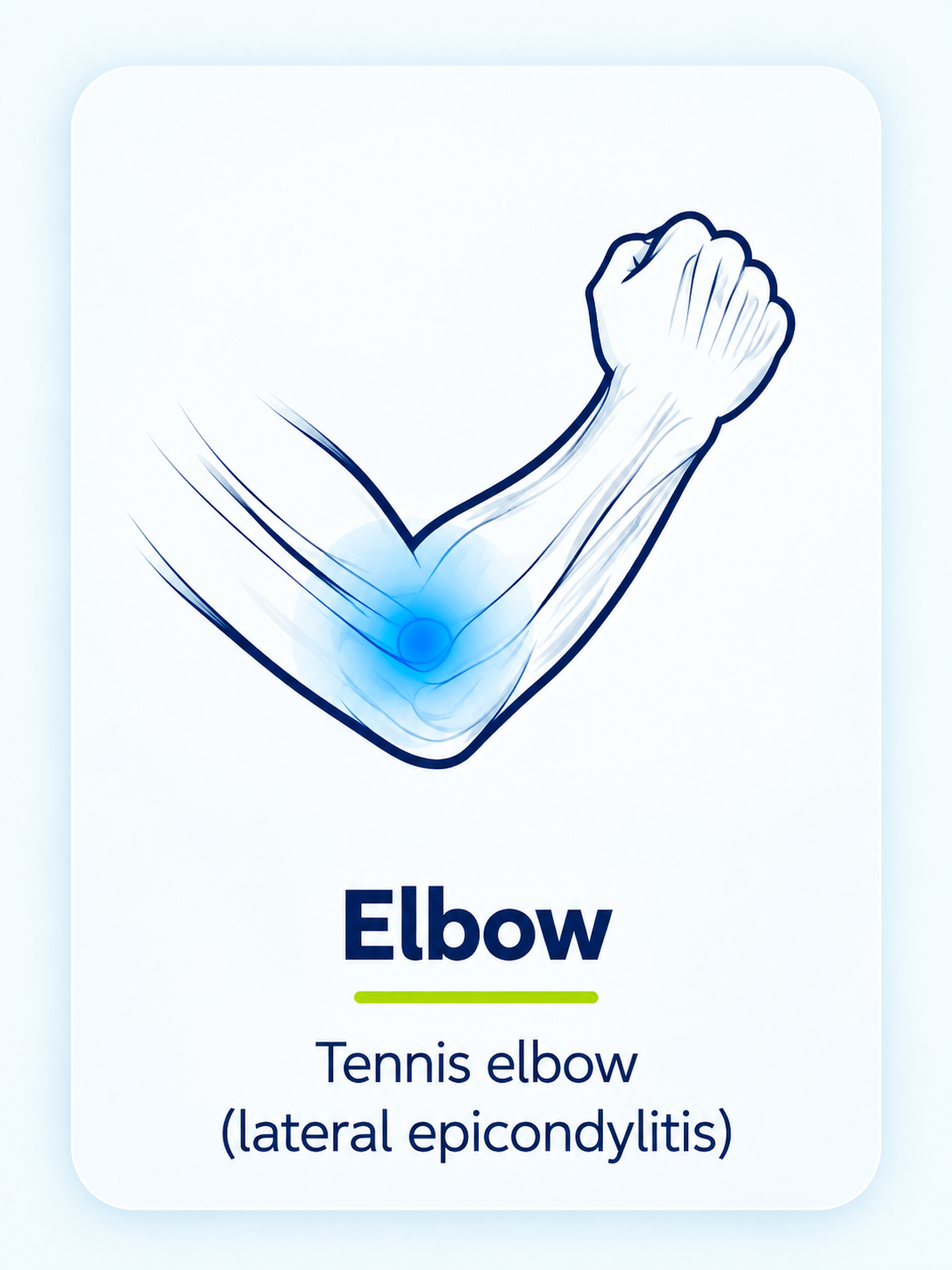 Elbow - Tennis elbow