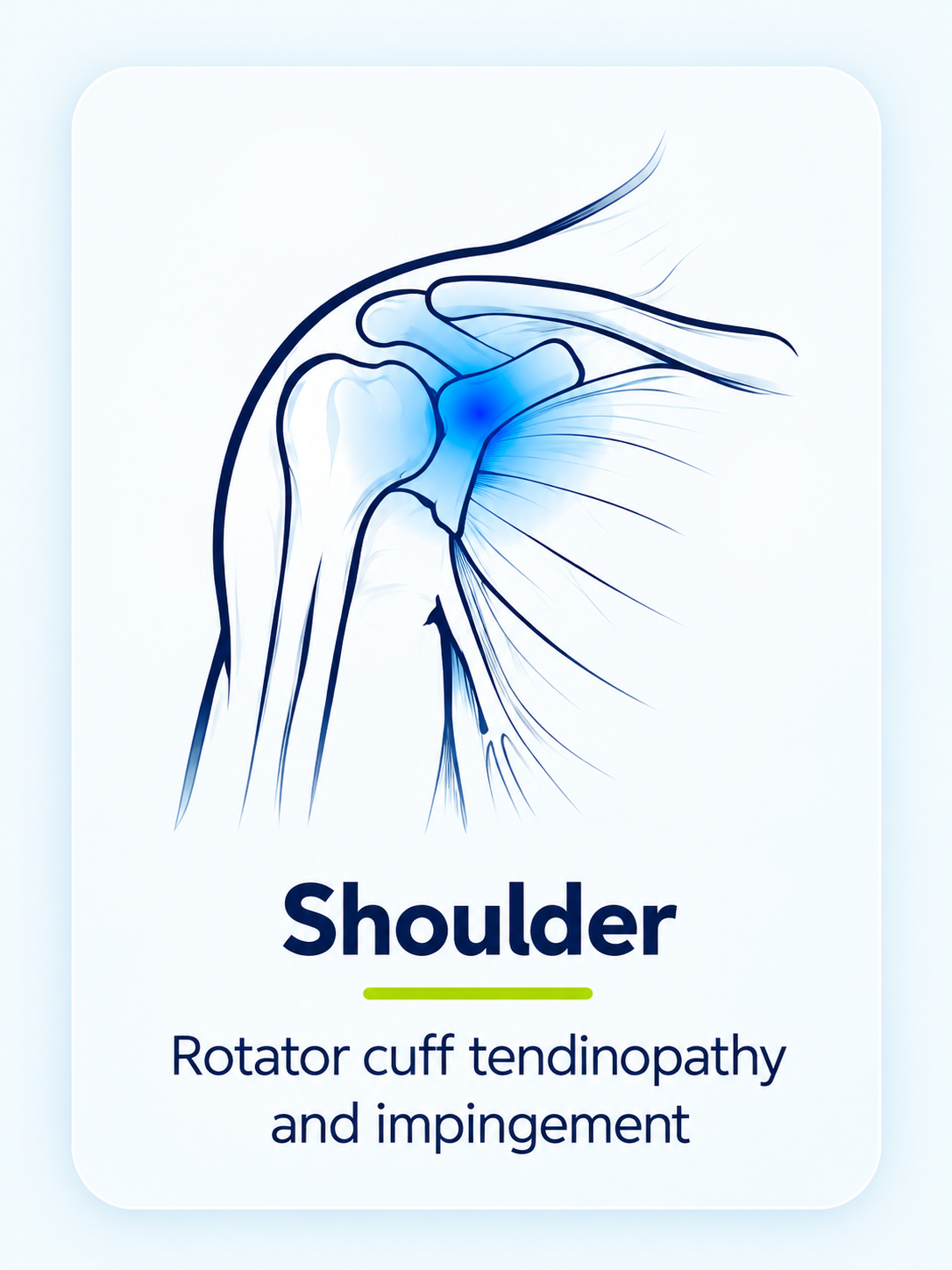 Shoulder - Rotator cuff tendinopathy and impingement